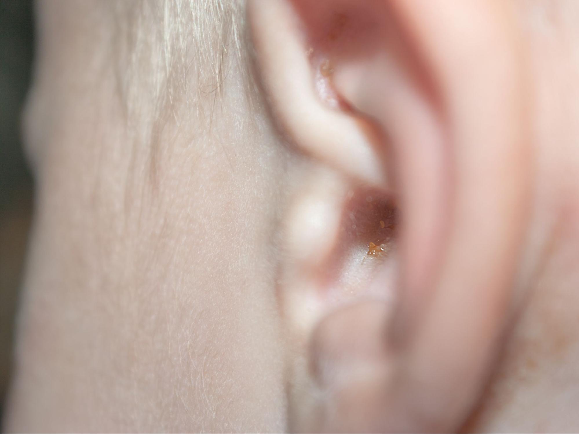how to clean your ears: Close up shot of an ear with earwax