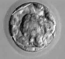 1AB-blastocyst.webp