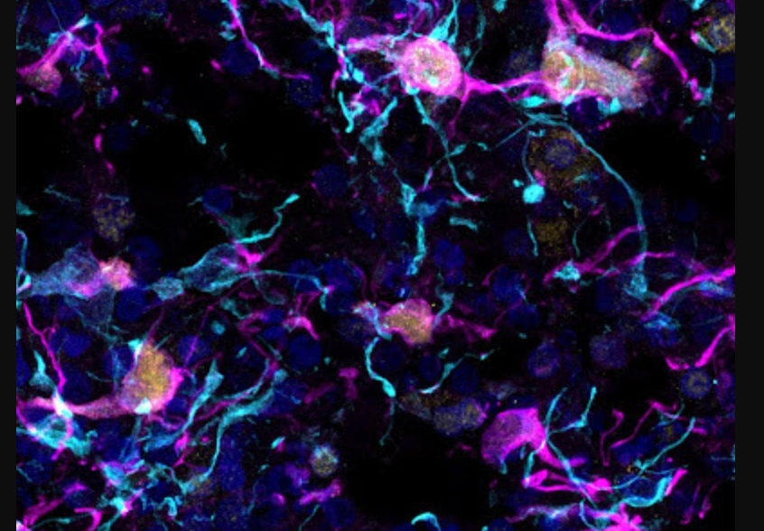 Lab-grown motor neuronal organoids in blue, pink, yellow, and black