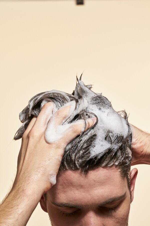 does-dandruff-cause-hair-loss