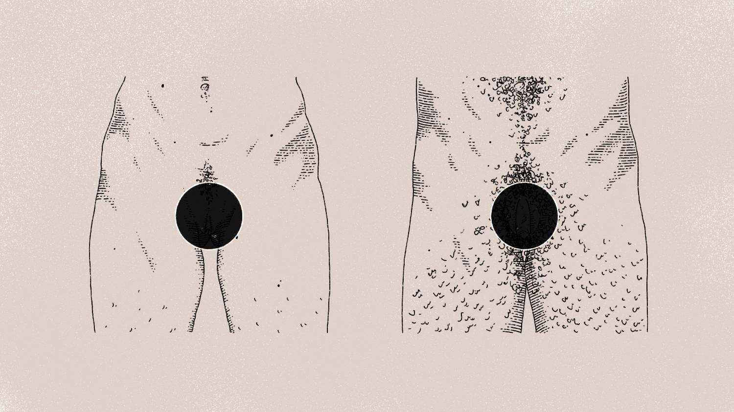 Two lower torsos next to each other with a black censor circles over their genitalia.