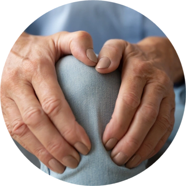 Arthritis Treatment: 6 Workarounds for Arthritis
