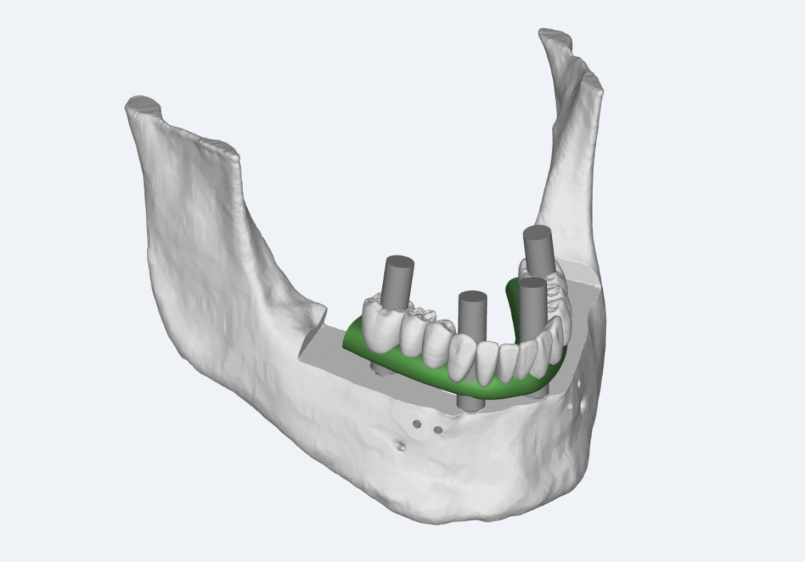 Absolute Dental landing page img.jpg