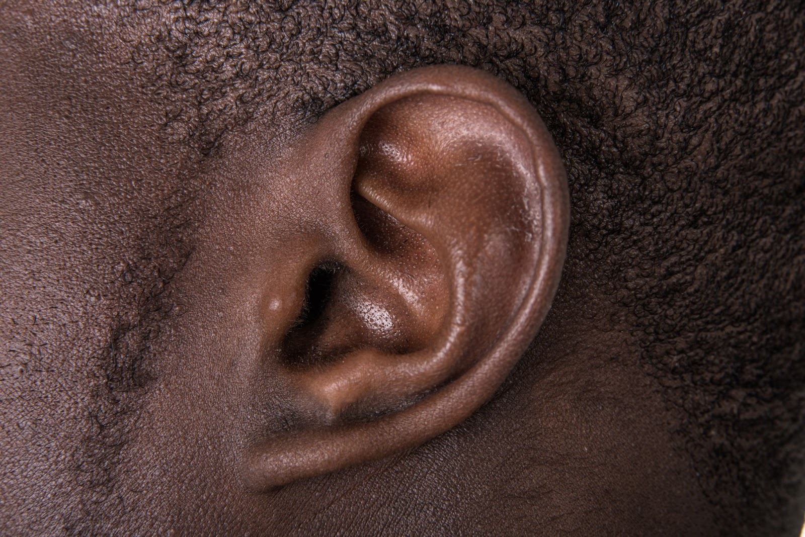 Ear congestion: A closeup of an ear