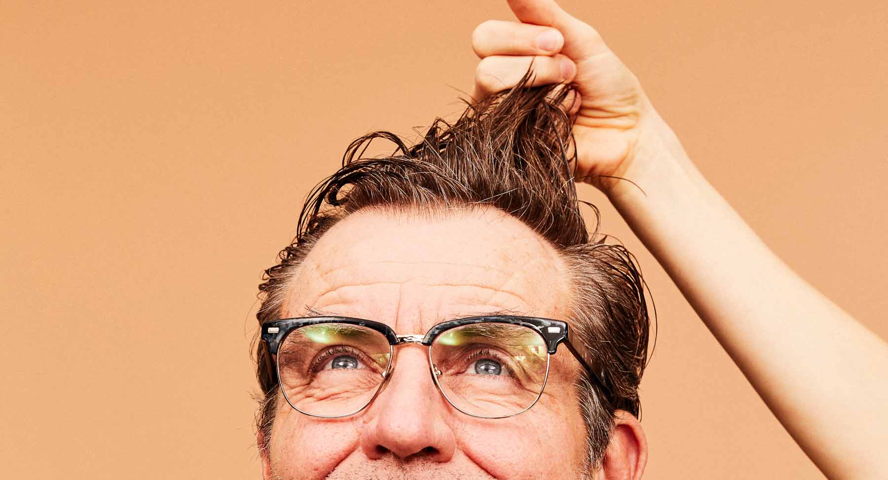 Does Dandruff Cause Hair Loss?