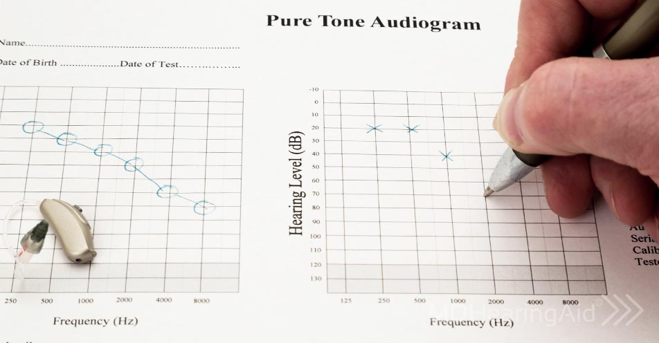 What Is an Audiogram? And How Do You Read It?