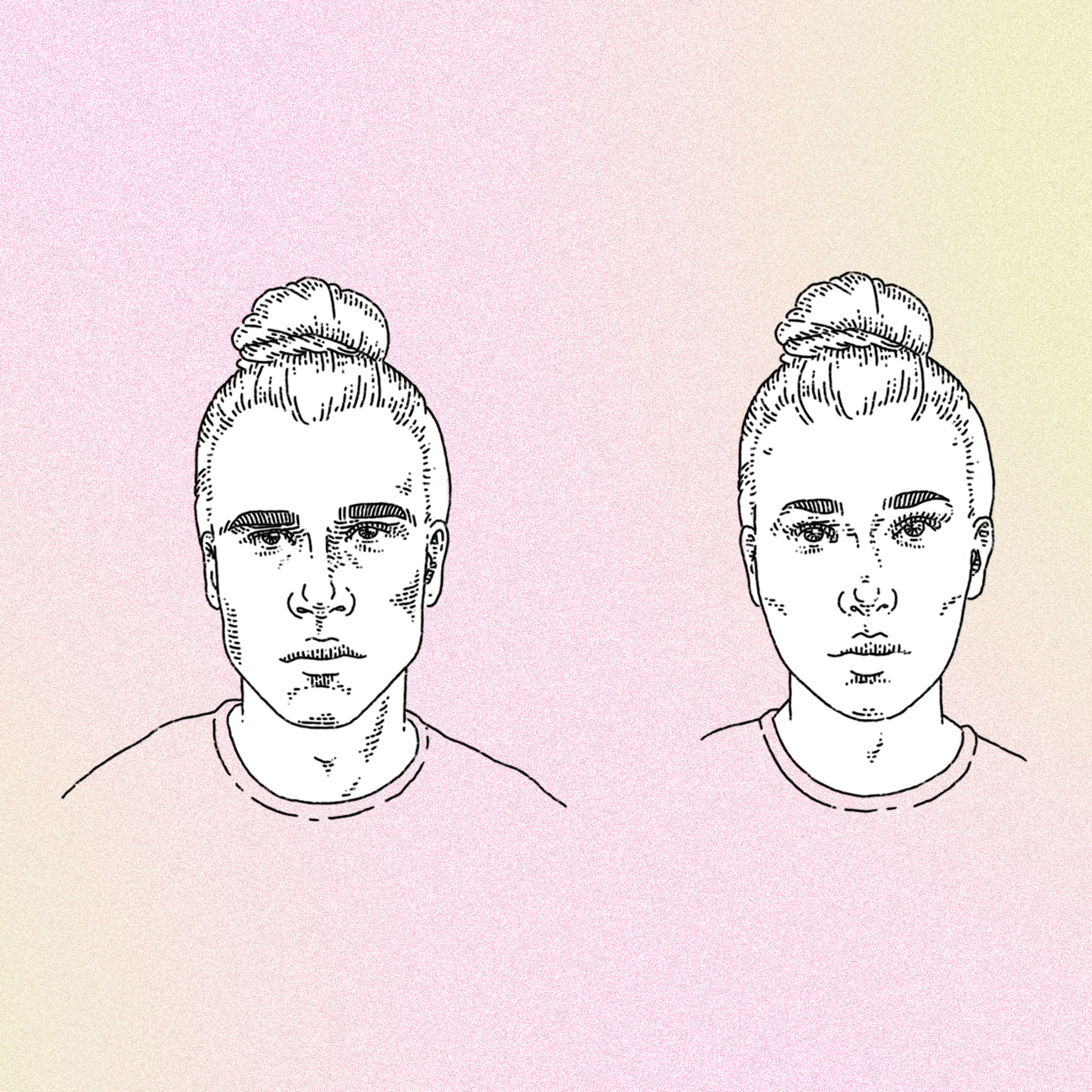 Facial feminization illustration