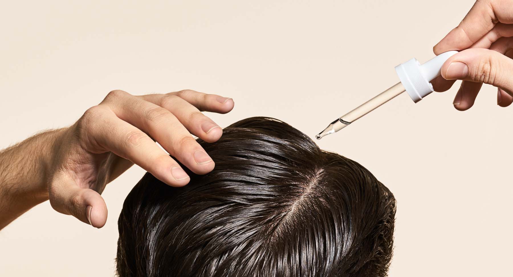 cara melebatkan rambut dengan Minoxidil 