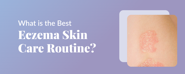 What Is The Best Eczema Skin Care Routine