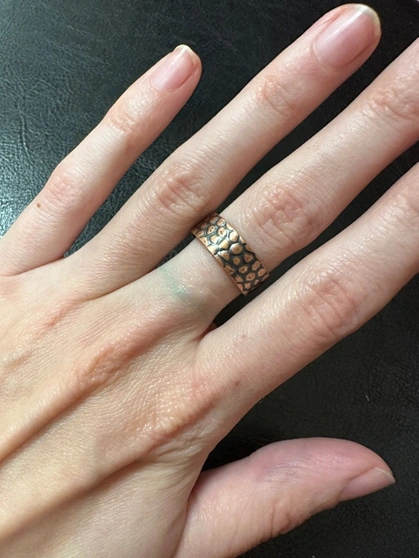 Finger is green from fake gold ring : r/jewelry