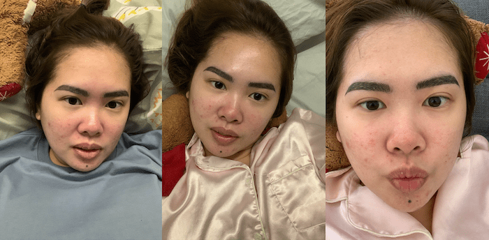 selfies during the first three days with the eyebrow embroidery