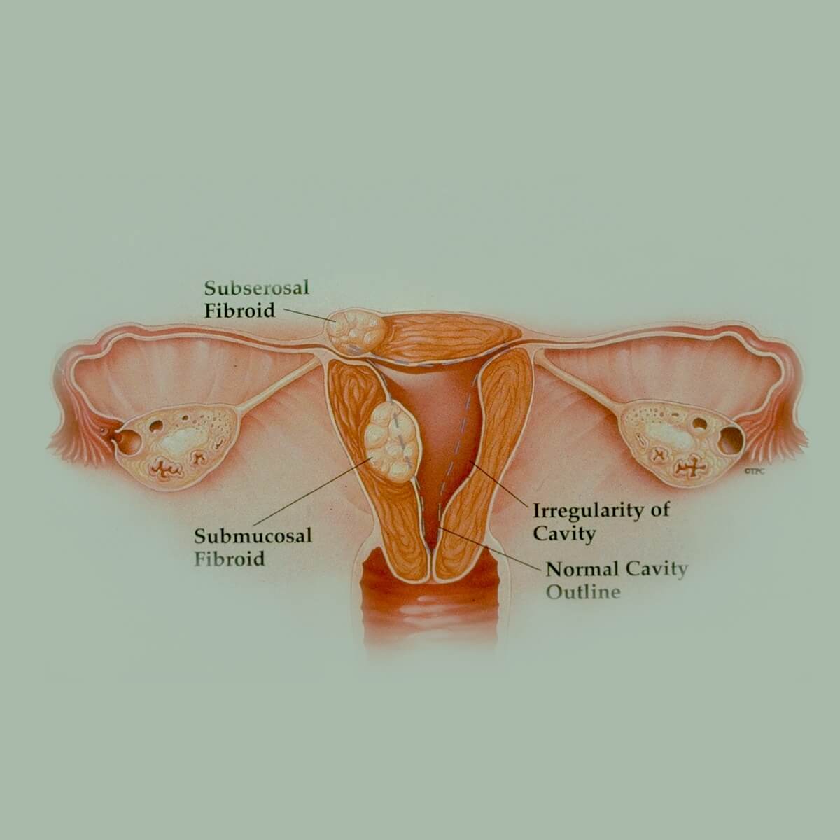 cross section of female reproductive organs