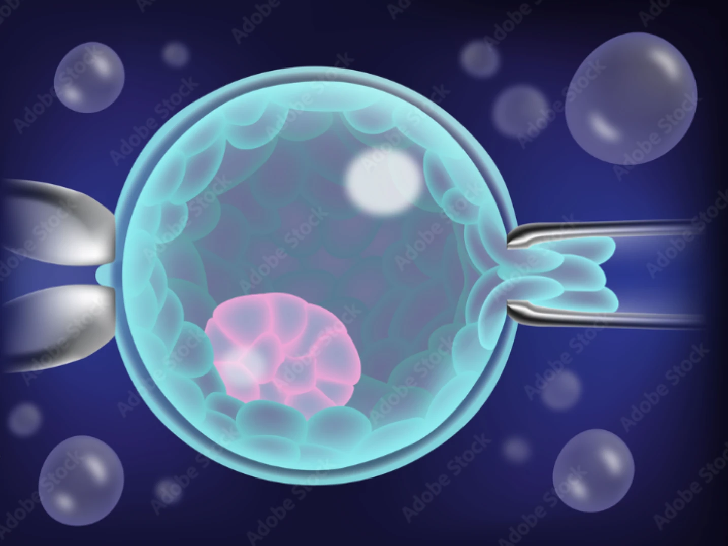IVF Cycle