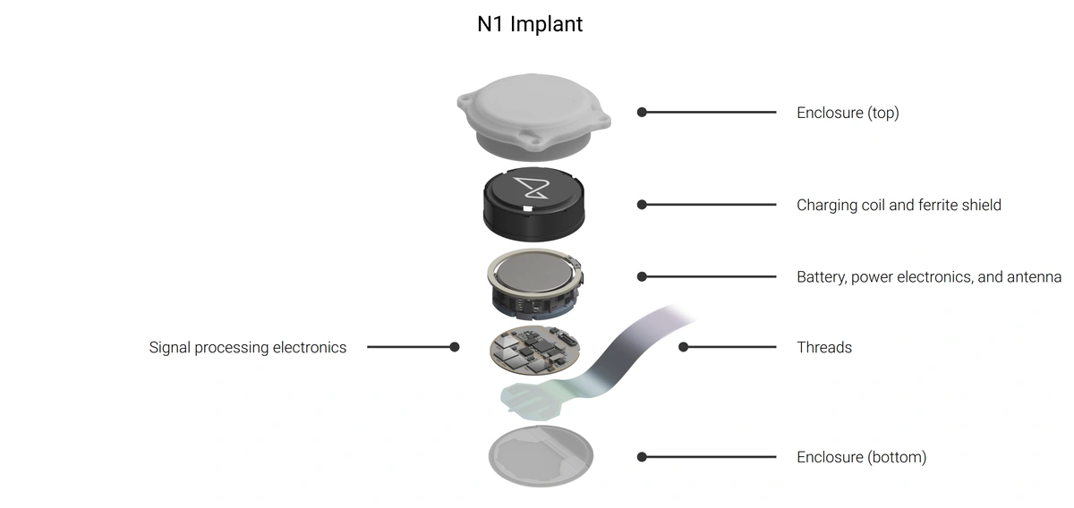 Impianto cerebrale N1 - fonte: Neuralink