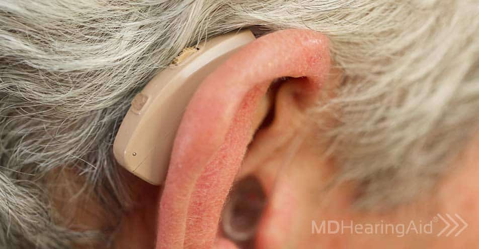 How Do Hearing Aids Work?