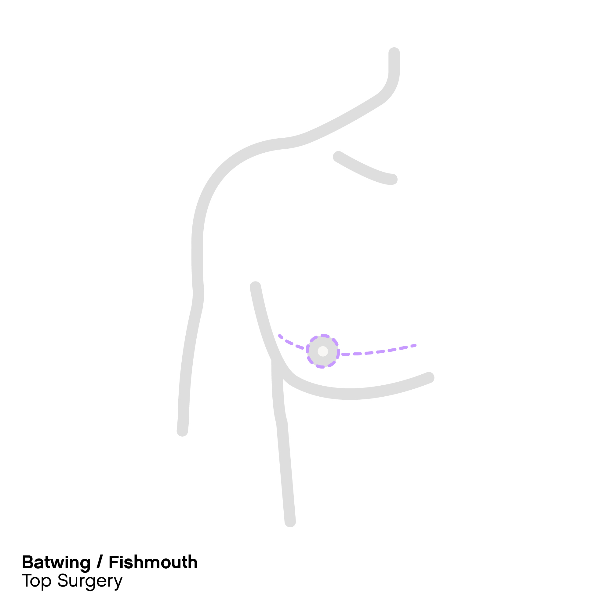 FOLX Health Top Surgery 101 Procedures, Cost, and Safety by FOLX