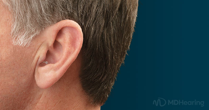 In Ear Hearing Aids: Pros, Cons, Features & More