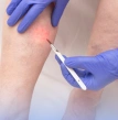 pessoa sendo avaliada por um cirurgião vascular
