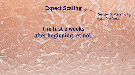 You should except to see scaling when beginning a retinol.