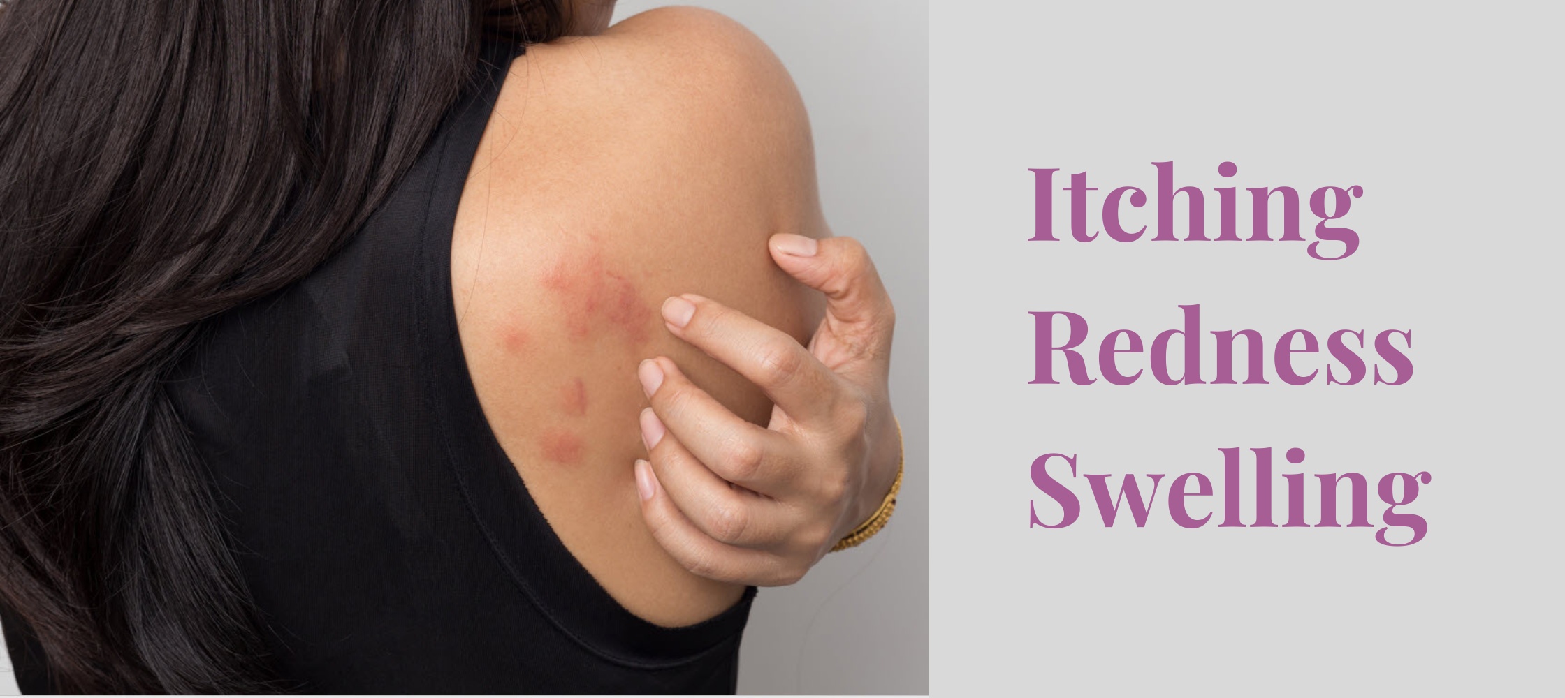 What is A Skin Allergy?