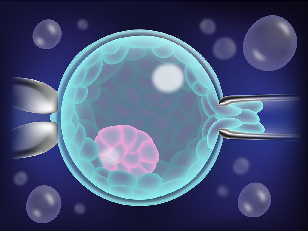 IVF Cycle