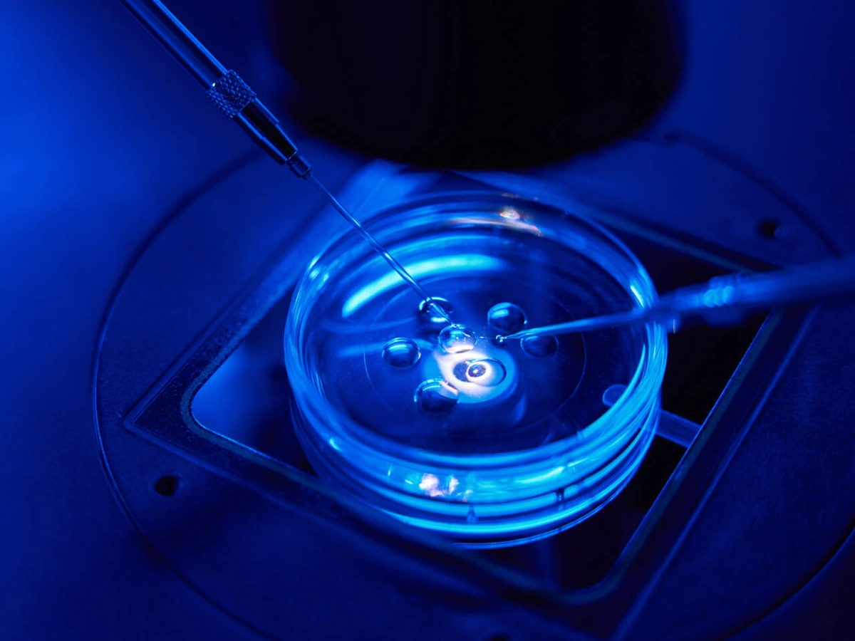 card How the IVF Process Works (1).webp