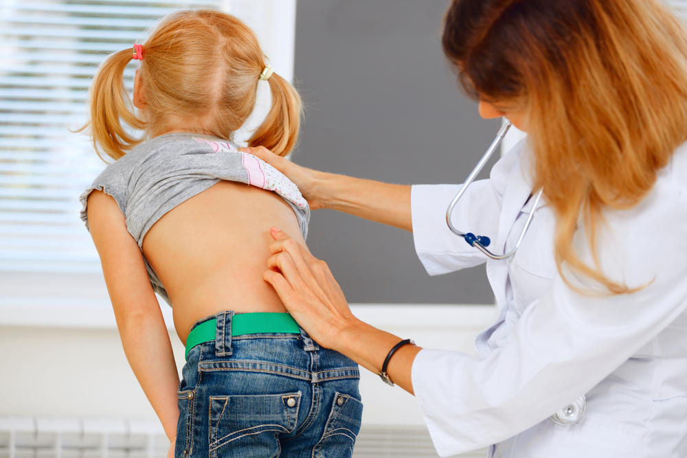 doctor looking for scoliosis in children