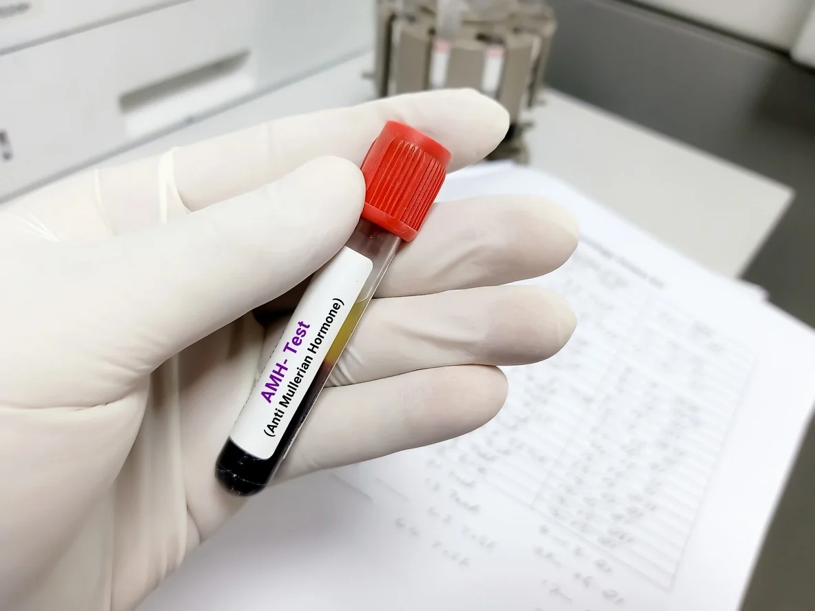 Test tube from AMH testing