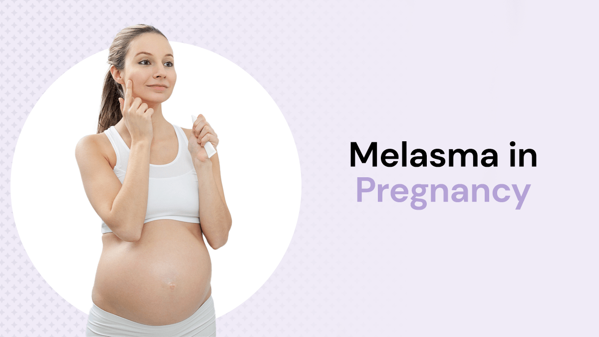 pregnant women with melasma on face