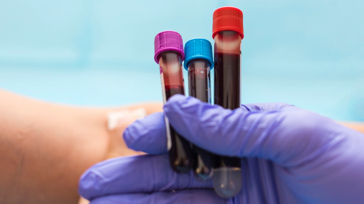 Blood testing tubes