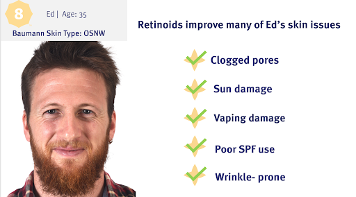 How Does Retinol Work On Wrinkles