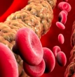 colesterol, acompanhamento médico preventivo