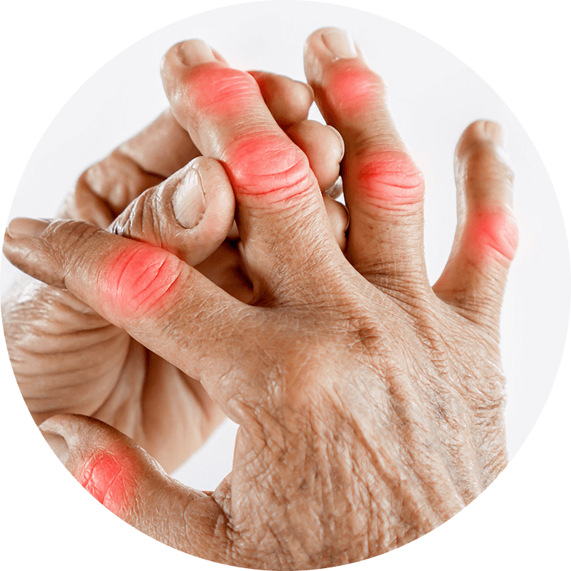 joint-pain-in-fingers-causes-and-solutions-rex-md