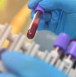 exame de sangue, consultas preventivas na especialidade de Hematologia