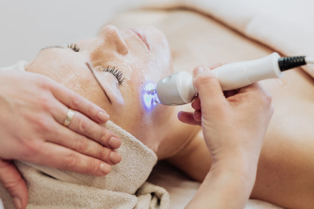 Woman receiving a laser acne treatment