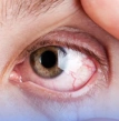 pessoa fazendo exame de visão, olhos em destaque