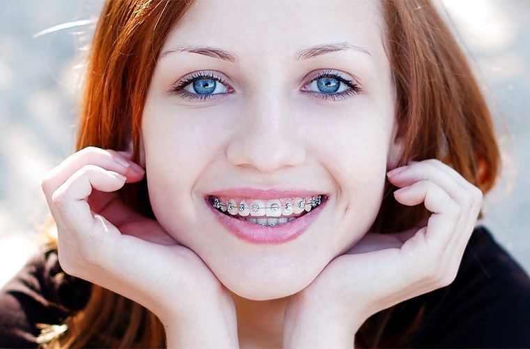 Orthodontics in Singapore how does it work