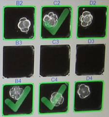 Blastocyst development chronicled in several slides