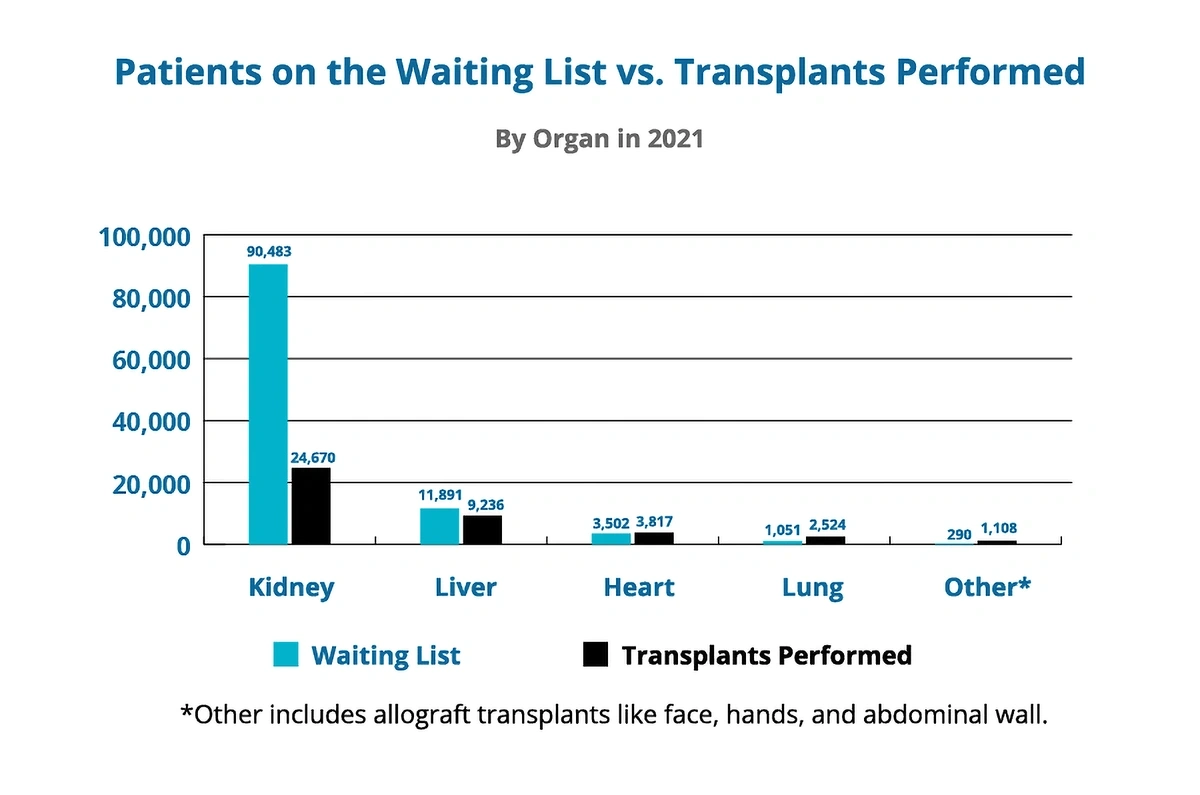 patients-waiting-organ-min.webp