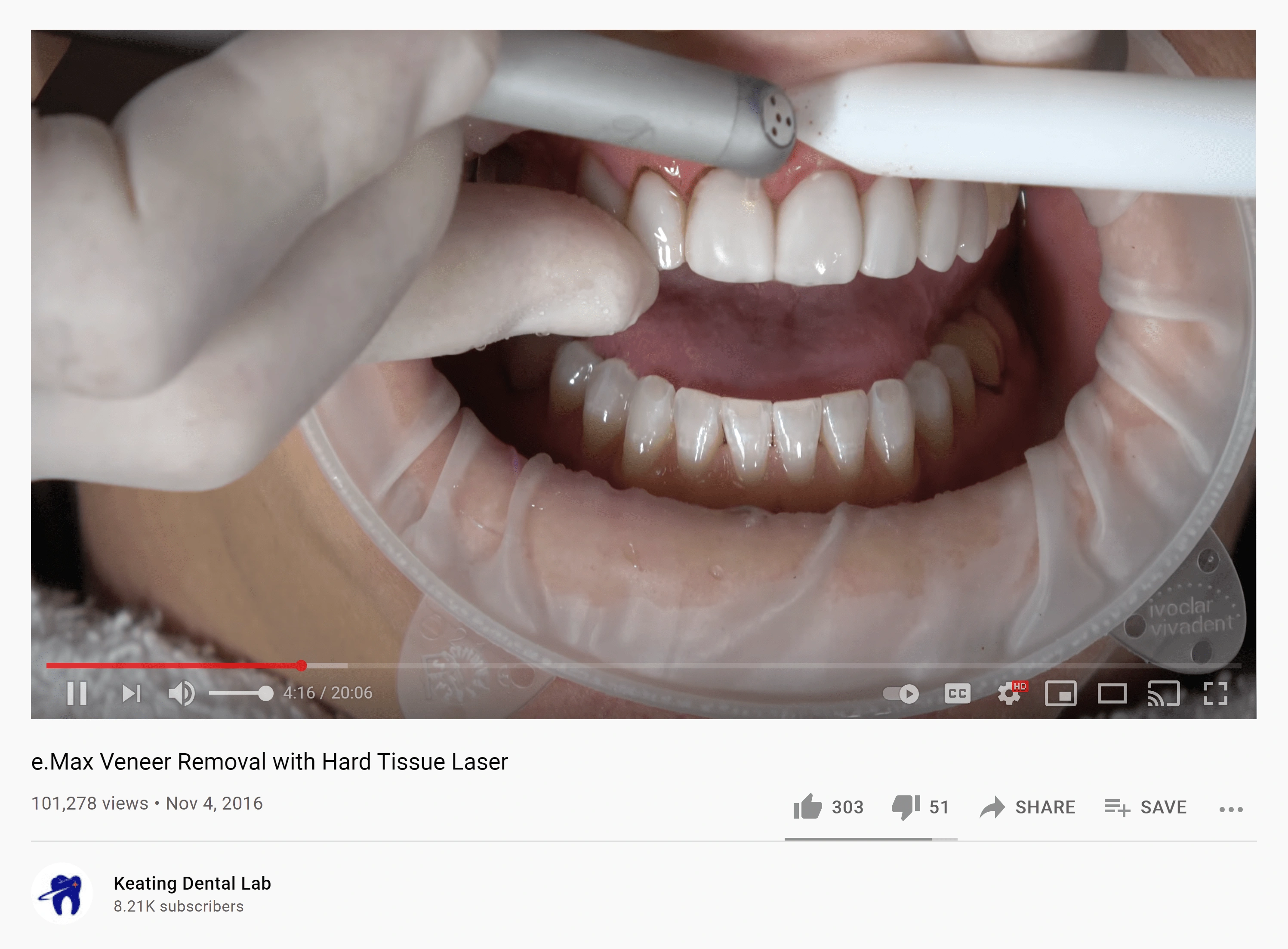 dental-laser-min.png