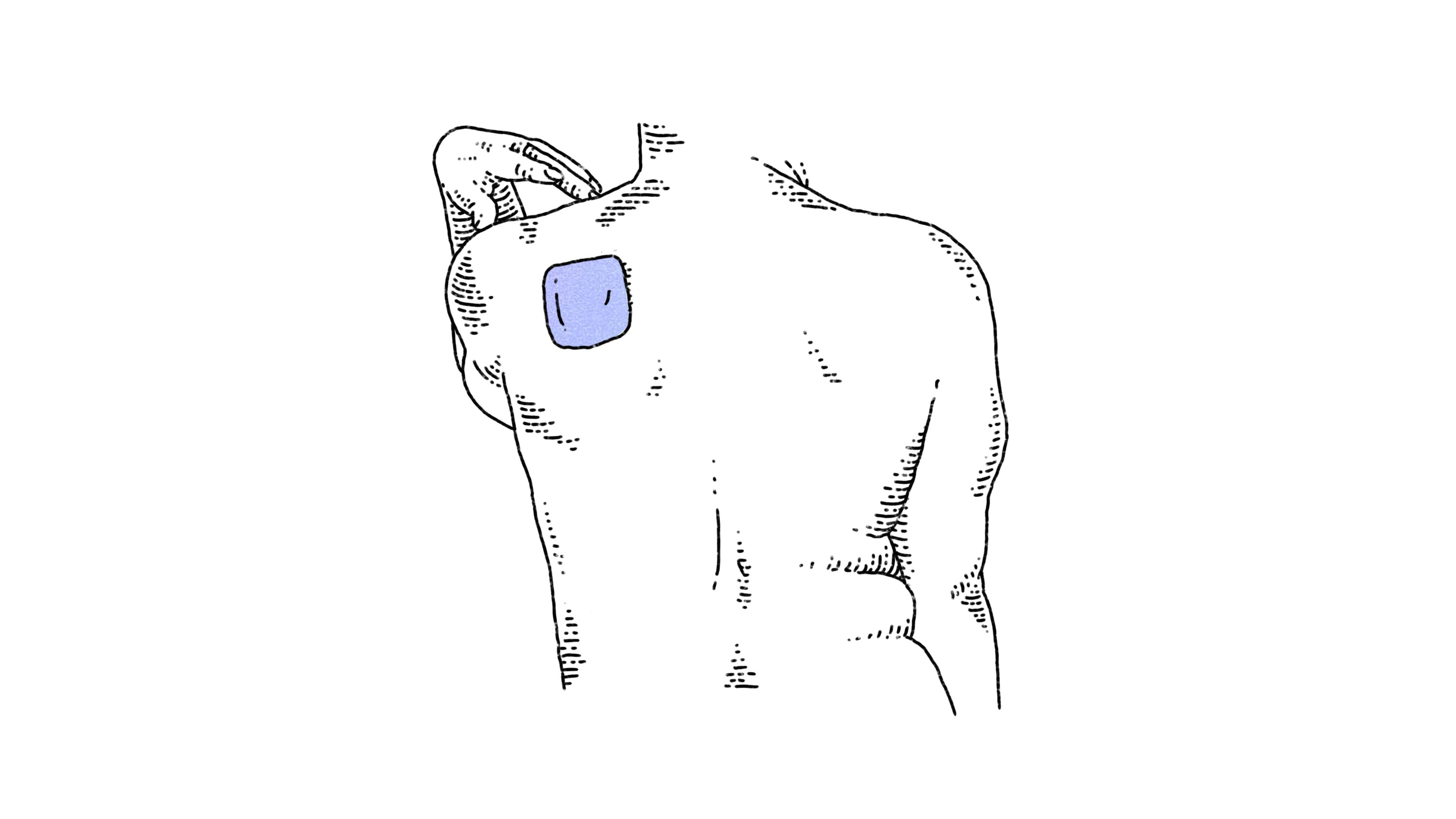 Estrogen patch on shoulder blade