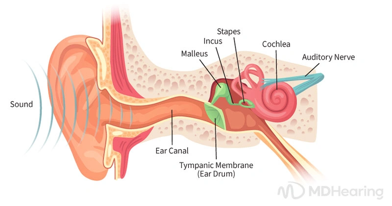 Types of Hearing Loss