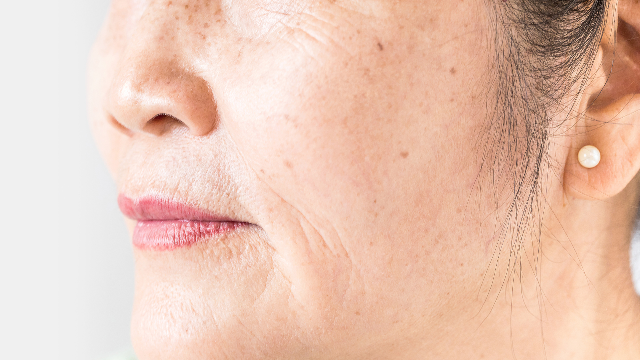 The Science and Causes of Skin Aging