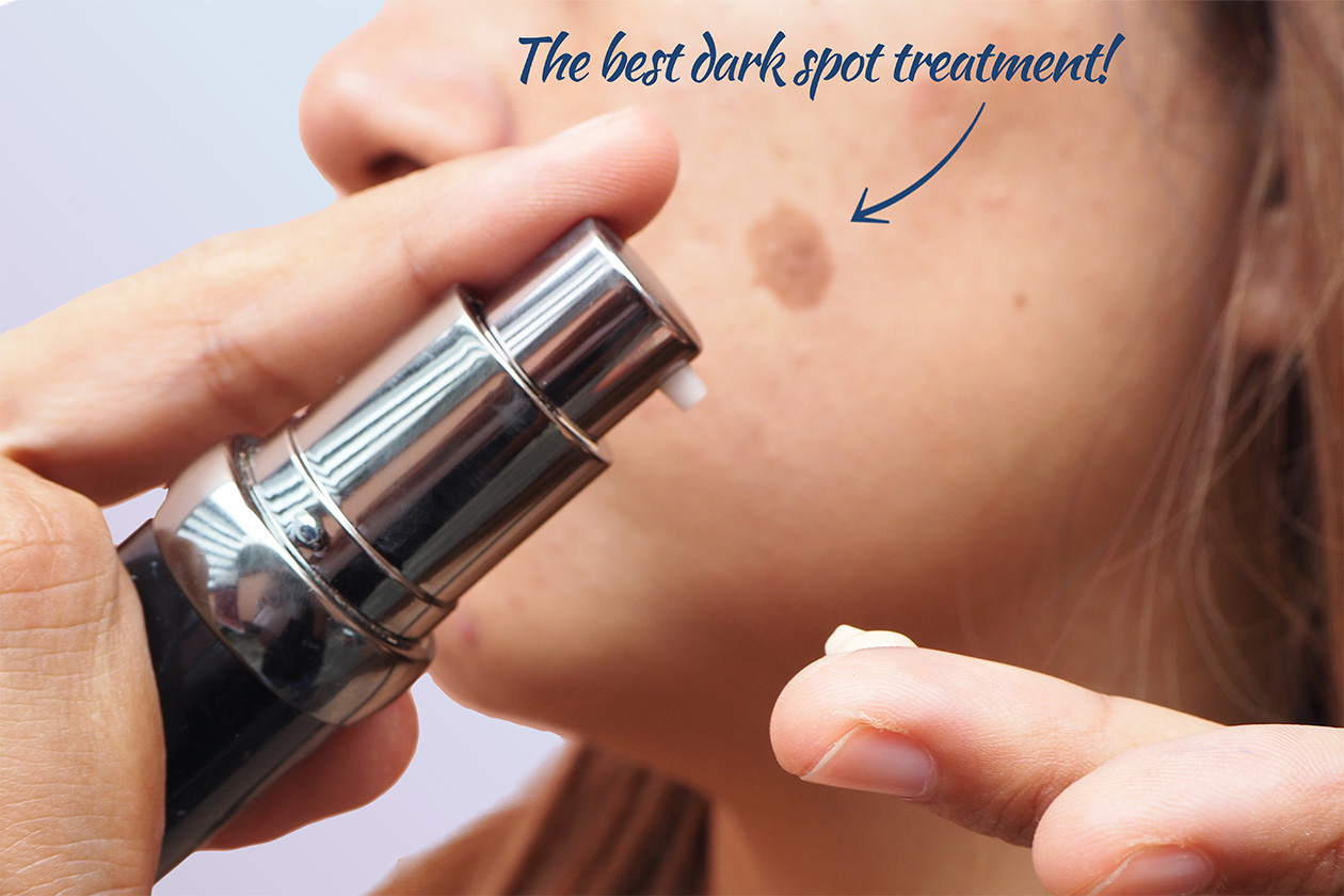 Best Dermatologist Recommended Treatment For Dark Spots On Face 