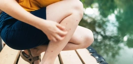 日本 腦 炎 症狀 潛伏期 疫苗 預防