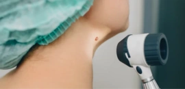 皮膚癌 症狀 成因 治療 診斷 前兆