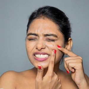 A Definitive Guide To Blood-Filled Pimples