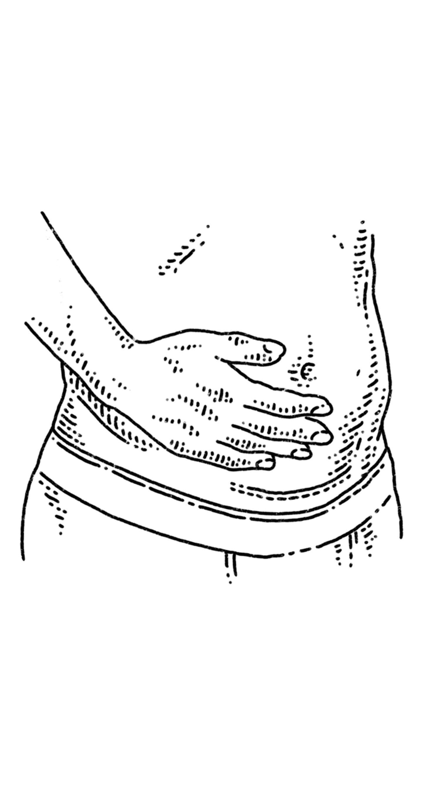 A hand placed over a lower abdomen with hysterectomy scar. 