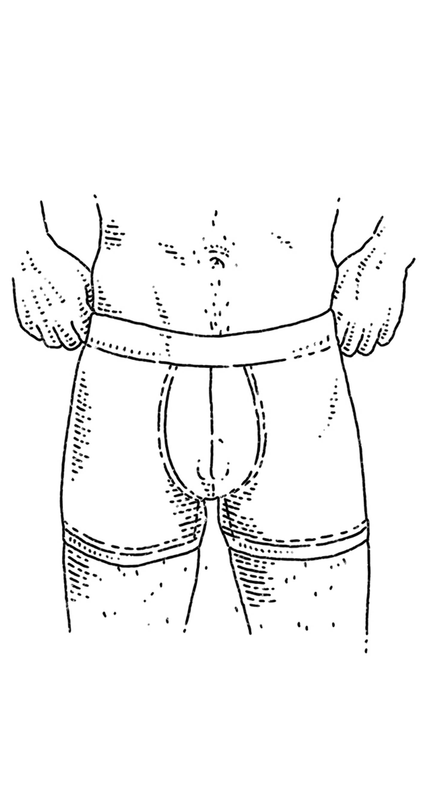an ftm transgender person standing with boxer briefs and their bottom growth showing 