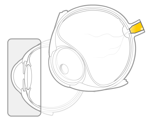 opticnerve.png